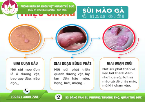 can-trong-voi-sui-mao-ga-duong-vat-dung-de-qua-muon-2187