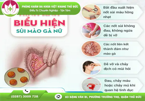 canh-bao-dau-hieu-sui-mao-ga-nu-can-biet-som-2090