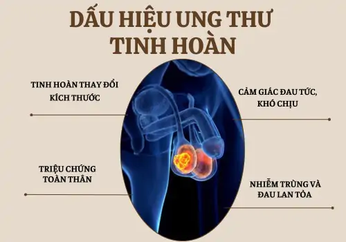 canh-bao-dau-hieu-ung-thu-tinh-hoan-nam-gioi-can-biet-de-de-phong-1140