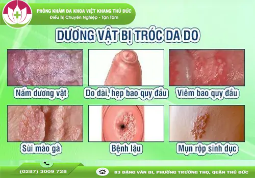 canh-bao-duong-vat-bi-troc-da-dau-hieu-benh-ly-nguy-hiem-1716