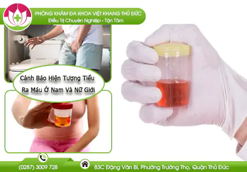 canh-bao-hien-tuong-tieu-ra-mau-o-nam-va-nu-gioi-999
