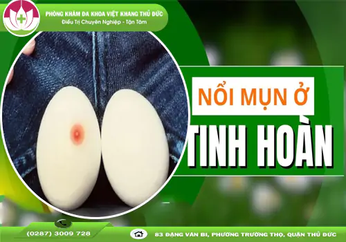 canh-bao-mun-tinh-hoan-dau-hieu-benh-gi-1536