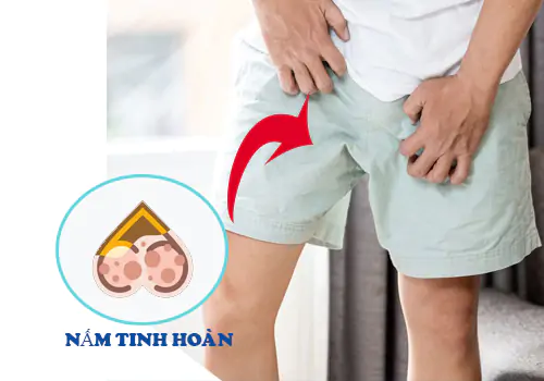canh-bao-nam-tinh-hoan-dau-hieu-nhan-biet-va-cach-dieu-tri-1172