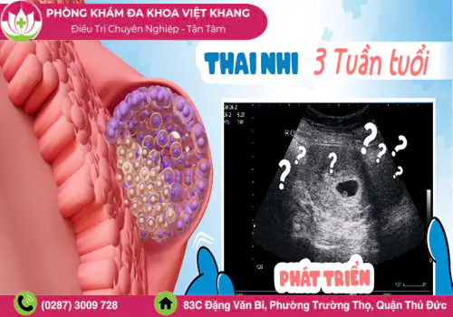 canh-bao-pha-thai-3-tuan-sai-cach-co-the-gay-nguy-hiem-1986