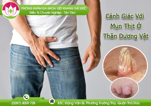 canh-giac-voi-mun-thit-o-than-duong-vat-979