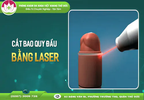 cat-bao-quy-dau-bang-laser-o-dau-khong-dau-1563