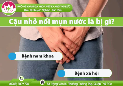 cau-nho-noi-mun-nuoc-la-bi-gi-761
