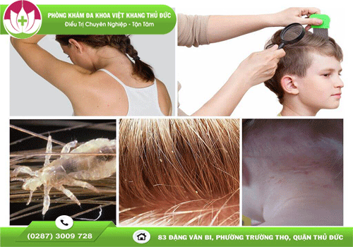 nguyen-nhan-gay-chay-ran-va-cach-loai-bo-an-toan-1804