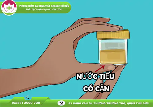 chi-diem-nguyen-nhan-khien-nuoc-tieu-co-can-1609