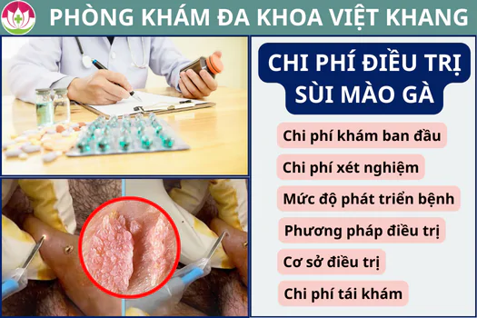 chi-phi-chua-sui-mao-ga-het-bao-nhieu-tien-bang-gia-moi-cap-nhat-1262