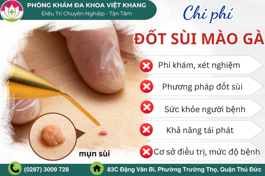 gia-dot-sui-mao-ga-hien-nay-la-bao-nhieu-1683