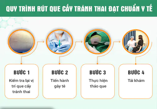 Quy trình tháo que tránh thai đạt chuẩn y tế tại phòng khám Việt Khang