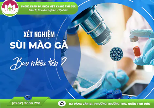 chi-phi-xet-nghiem-sui-mao-ga-bao-nhieu-nhung-yeu-to-anh-huong-2026