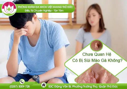 chua-quan-he-co-bi-sui-mao-ga-khong-1050