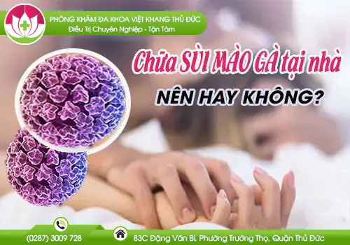 co-nen-dieu-tri-sui-mao-ga-tai-nha-khong-391