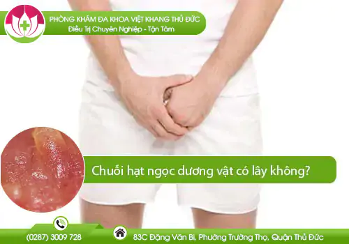 chuoi-hat-ngoc-duong-vat-co-lay-khong-627