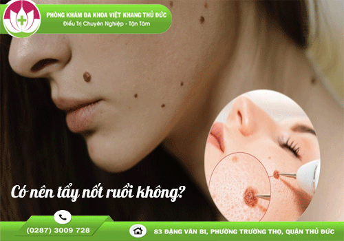 tay-xoa-pha-not-ruoi-bang-cong-nghe-hien-dai-va-an-toan-1757