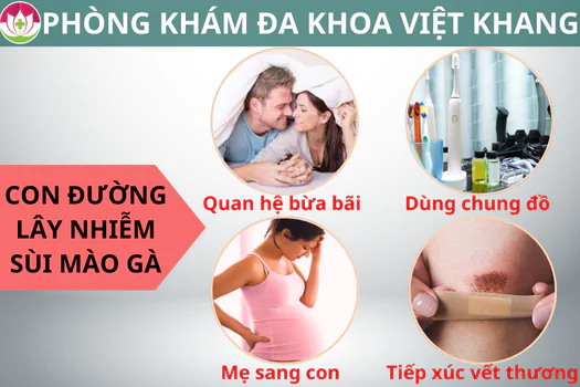 sui-mao-ga-lay-qua-duong-nao-cach-nhan-biet-benh-1266