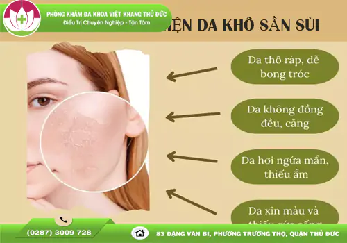 da-kho-san-sui-va-cach-tri-dung-huong-dan-tu-chuyen-gia-2082