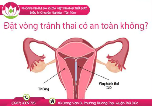 dat-vong-tranh-thai-co-an-toan-khong-nen-dat-vao-thoi-diem-nao-649