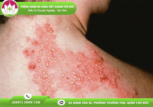 Việt Khang Thủ Đức
