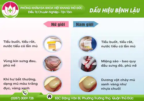 dau-hieu-nhan-biet-benh-lau-350