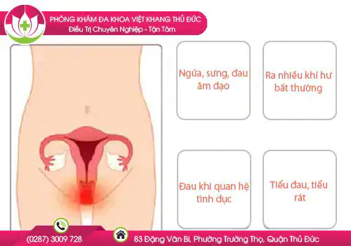 dau-hieu-nao-can-di-kiem-tra-am-dao-ngay-641