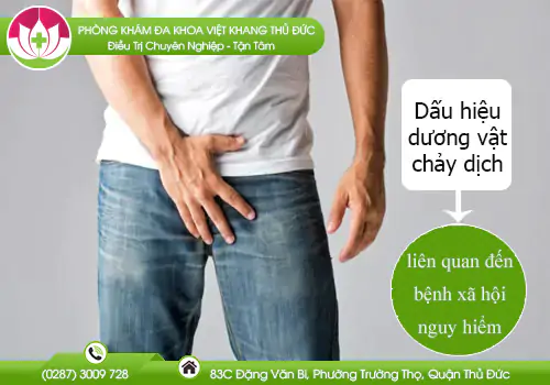 dau-hieu-duong-vat-chay-dich-va-cac-benh-lien-quan-717