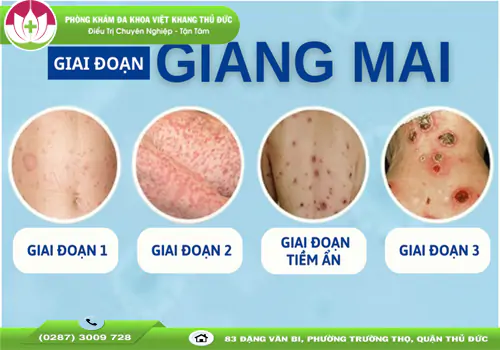 dau-hieu-giang-mai-nhan-biet-som-de-tranh-bien-chung-nguy-hiem-1594