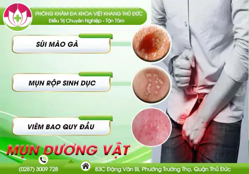 mun-duong-vat-dau-hieu-dau-tien-cua-benh-xa-hoi-171