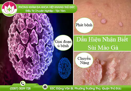 dau-hieu-nhan-biet-sui-mao-ga-864