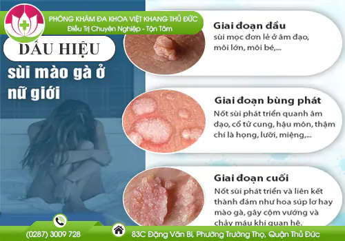 dau-hieu-sui-mao-ga-o-nu-813