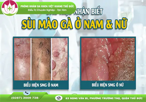 dau-hieu-sui-mao-ga-vung-kin-nam-va-nu-canh-bao-som-2030