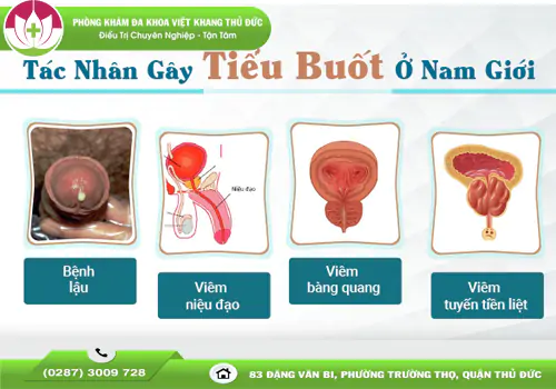 di-tieu-bi-dau-buot-benh-gi-co-nguy-hiem-khong-va-cach-dieu-tri-2103