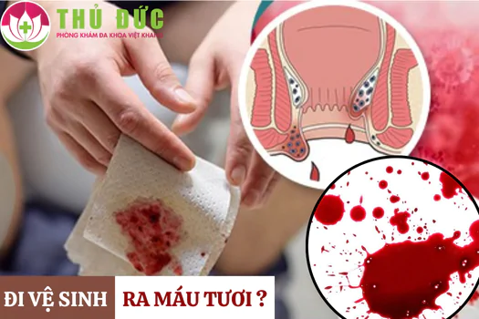 Việt Khang Thủ Đức