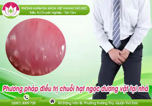 phuong-phap-dieu-tri-chuoi-hat-ngoc-duong-vat-tai-nha-535