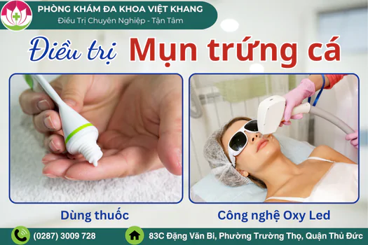chuyen-gia-chia-se-cach-tri-mun-trung-ca-hieu-qua-1880