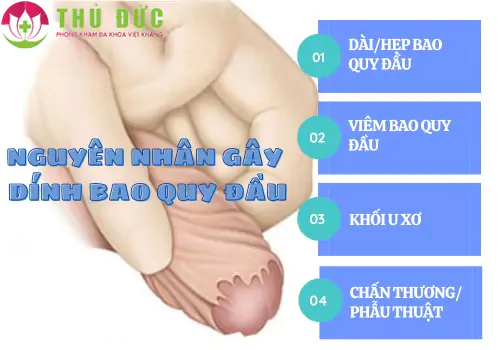 Nguyên nhân gây dính bao quy đầu