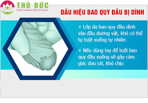 dinh-bao-quy-dau-la-gi-co-sao-khong-1246