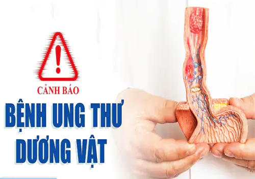 Ung thư dương vật là căn bệnh nguy hiểm cần khám điều trị sớm