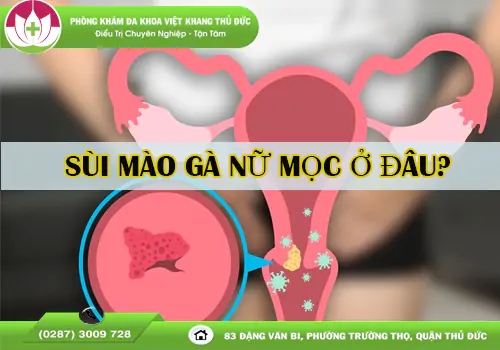 dung-bo-qua-sui-mao-ga-nu-moc-o-dau-va-nhan-biet-the-nao-2153