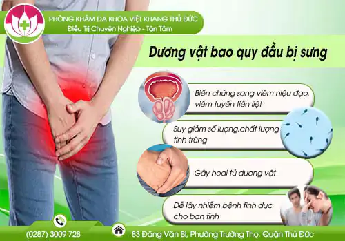 duong-vat-bao-quy-dau-bi-sung-khong-nen-chu-quan-210