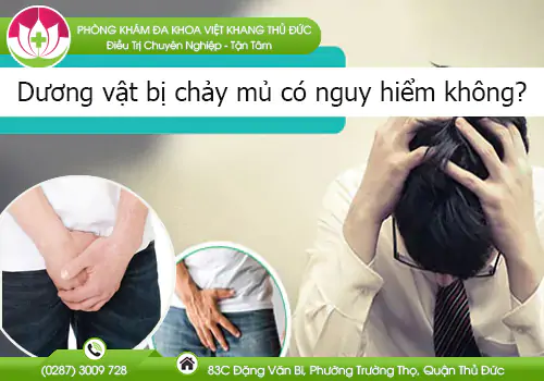 duong-vat-bi-chay-mu-co-nguy-hiem-khong-716