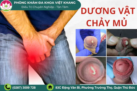 chia-se-cach-dieu-tri-duong-vat-bi-chay-mu-hien-dai-hieu-qua-1719