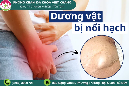 duong-vat-bi-noi-hach-la-benh-gi-dieu-tri-ra-sao-1957