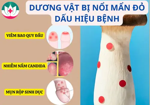 duong-vat-bi-noi-man-do-dau-hieu-khong-nen-bo-qua-1194