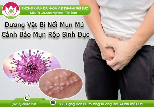 duong-vat-bi-noi-mun-mu-927