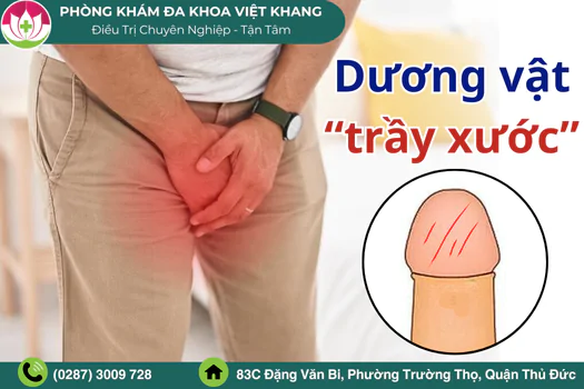 duong-vat-bi-tray-xuoc-co-sao-khong-boi-thuoc-gi-de-chong-lanh-1954