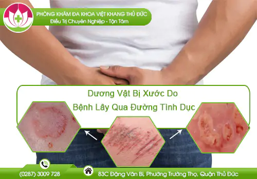 duong-vat-bi-xuoc-do-benh-lay-qua-duong-tinh-duc-1058