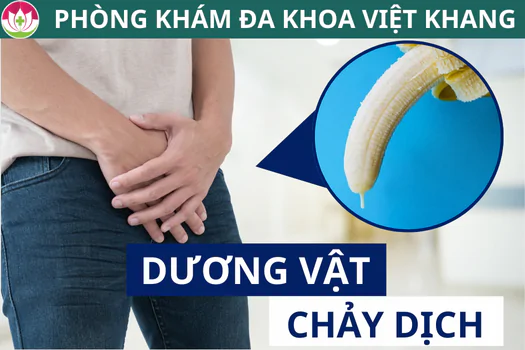 duong-vat-chay-dich-dau-hieu-benh-ly-khong-nen-chu-quan-1282